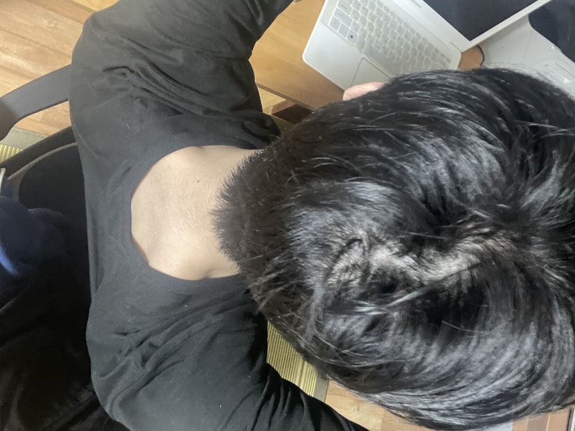 하루종일 누워있더니 이렇게 됨 후두부쪽에 가르마가 ?
