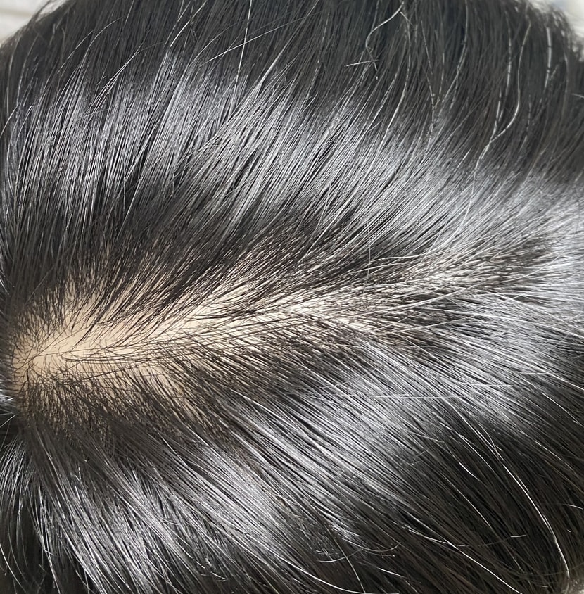 가르마 탄 사진