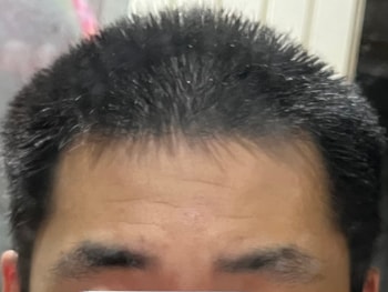 정면 