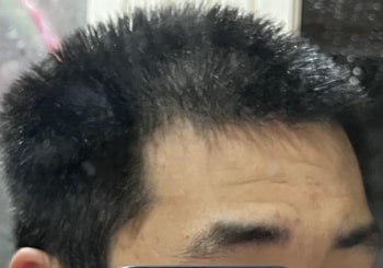 왼쪽 