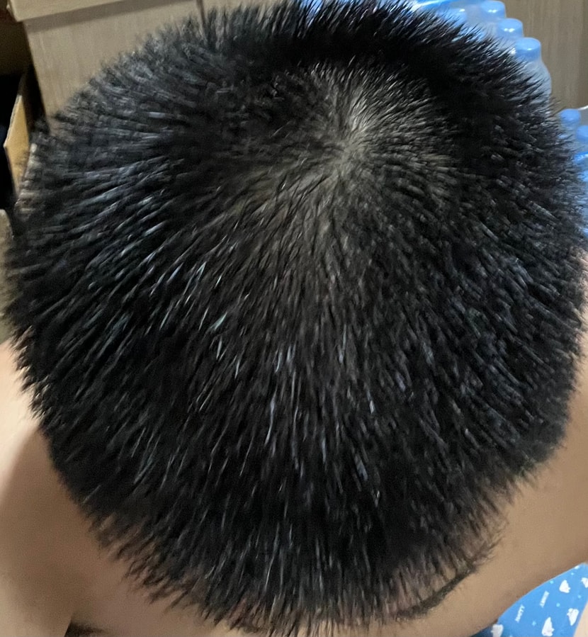 정수리