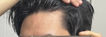 옆