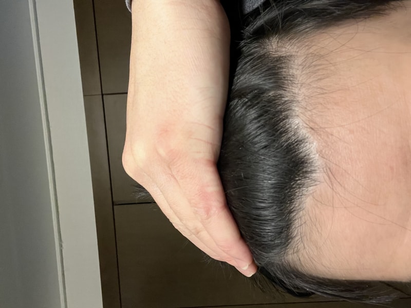 이거 앞머리 탈모 심한건가요??ㅠㅠ