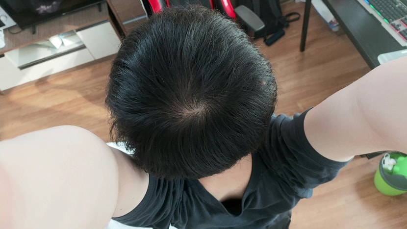 일반(형광등)