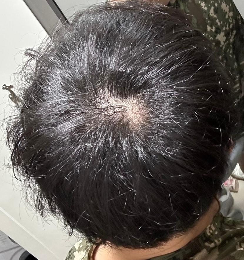 둘다 완전 빛 아래에서 찍은거야