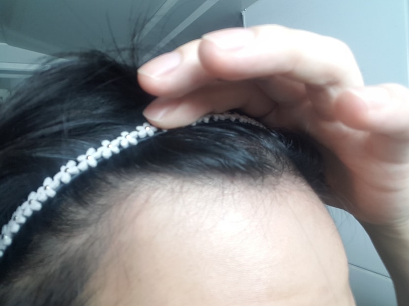 오른쪽