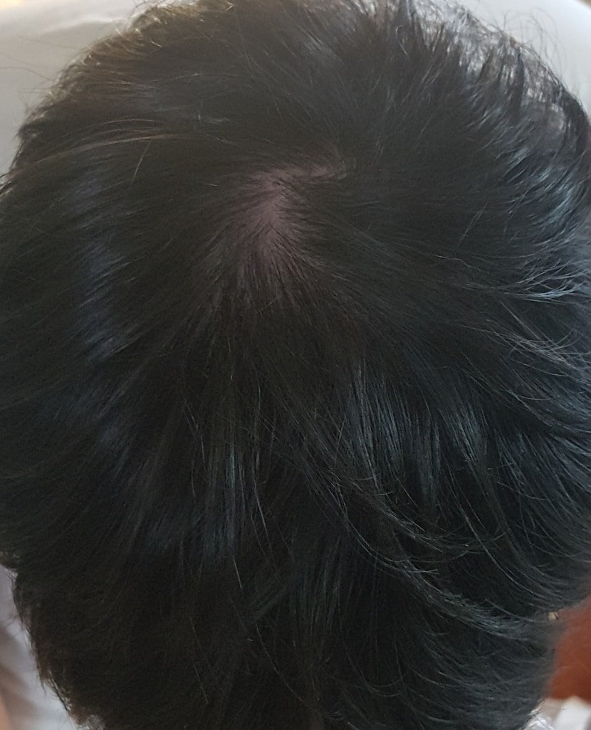 정수리