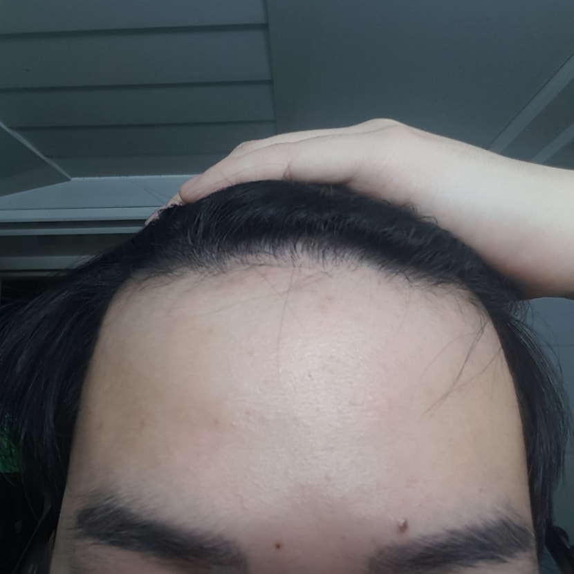 정면