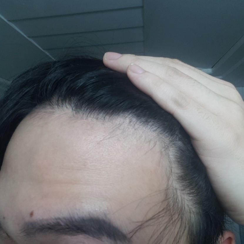왼쪽