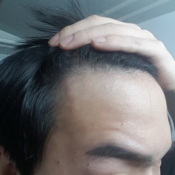 오른쪽2