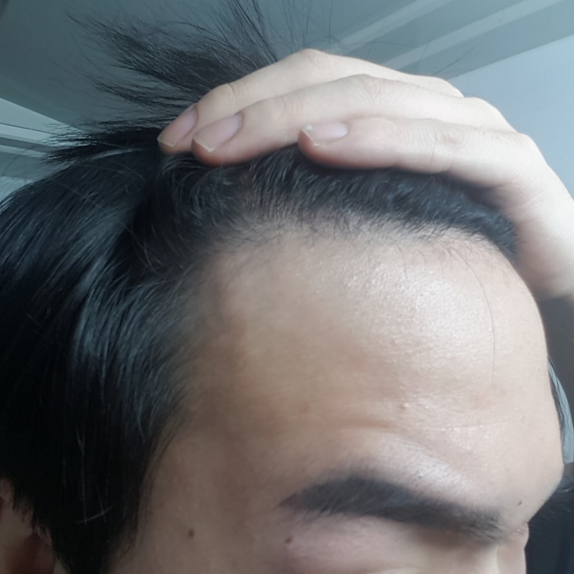 오른쪽2