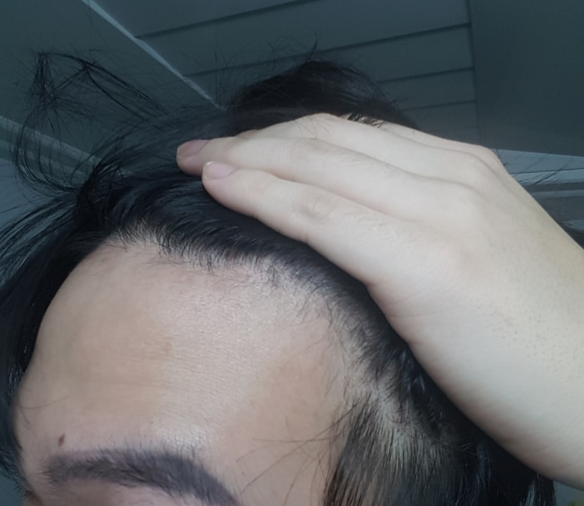 왼쪽2