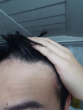 이마라인왼쪽