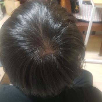 정수리