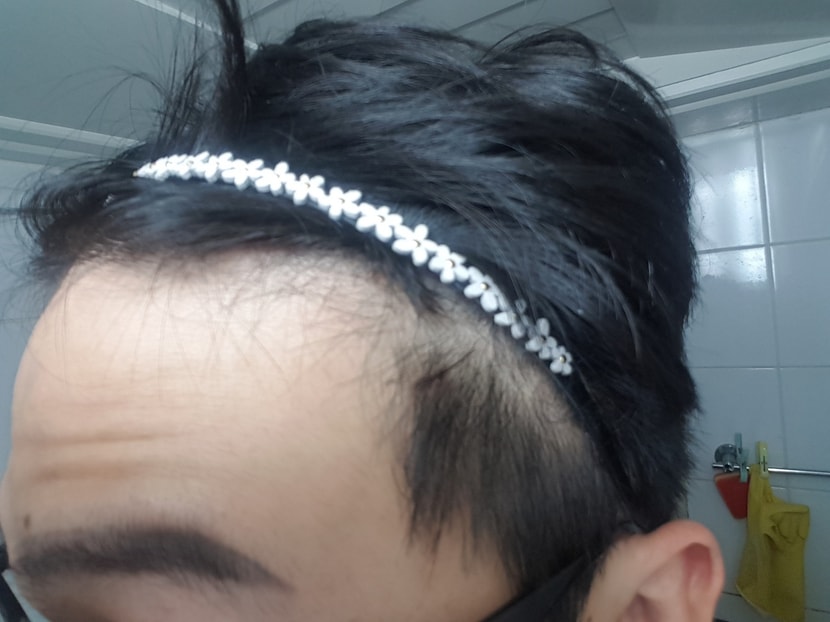 왼쪽2