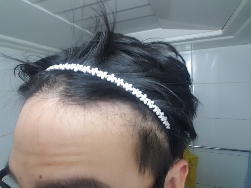 왼쪽1