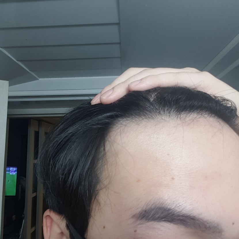 오른쪽