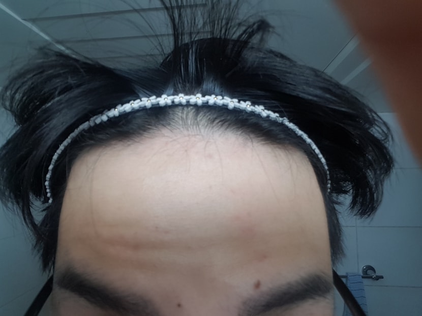 정면