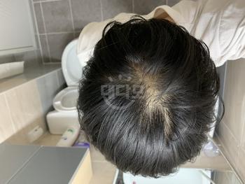 이건 심각성 깨닫고 복용하기 시작했을때