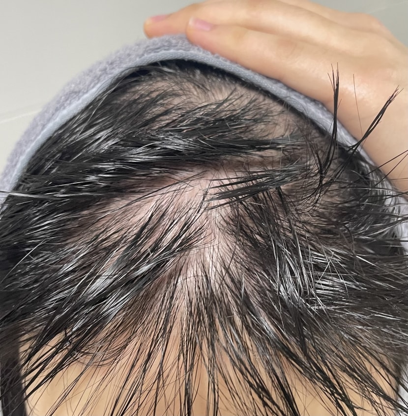 머리 말리기 전 속알머리ㅠㅠ