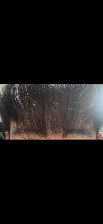 3개월 차 앞머리