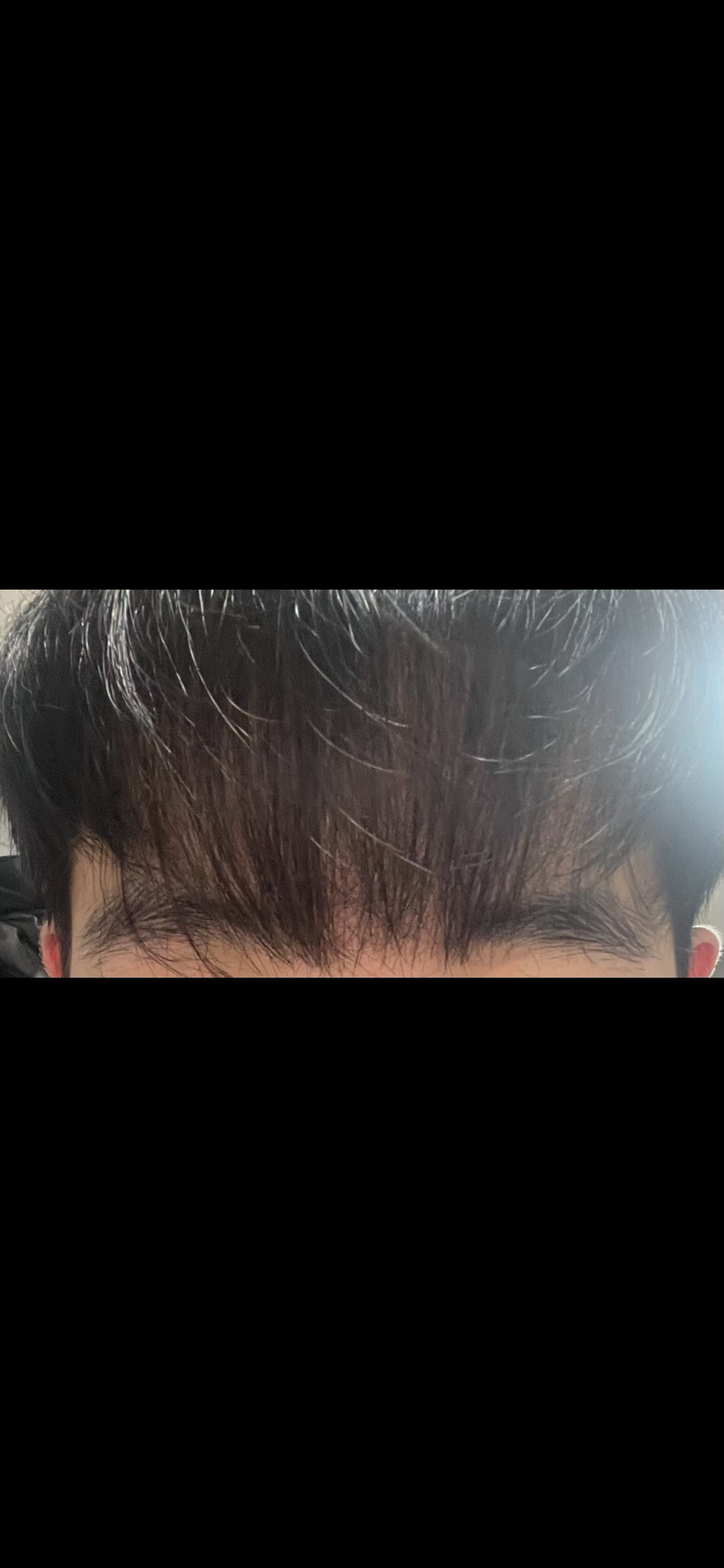 3개월 차 앞머리