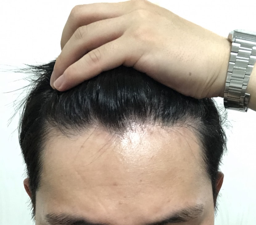 이마