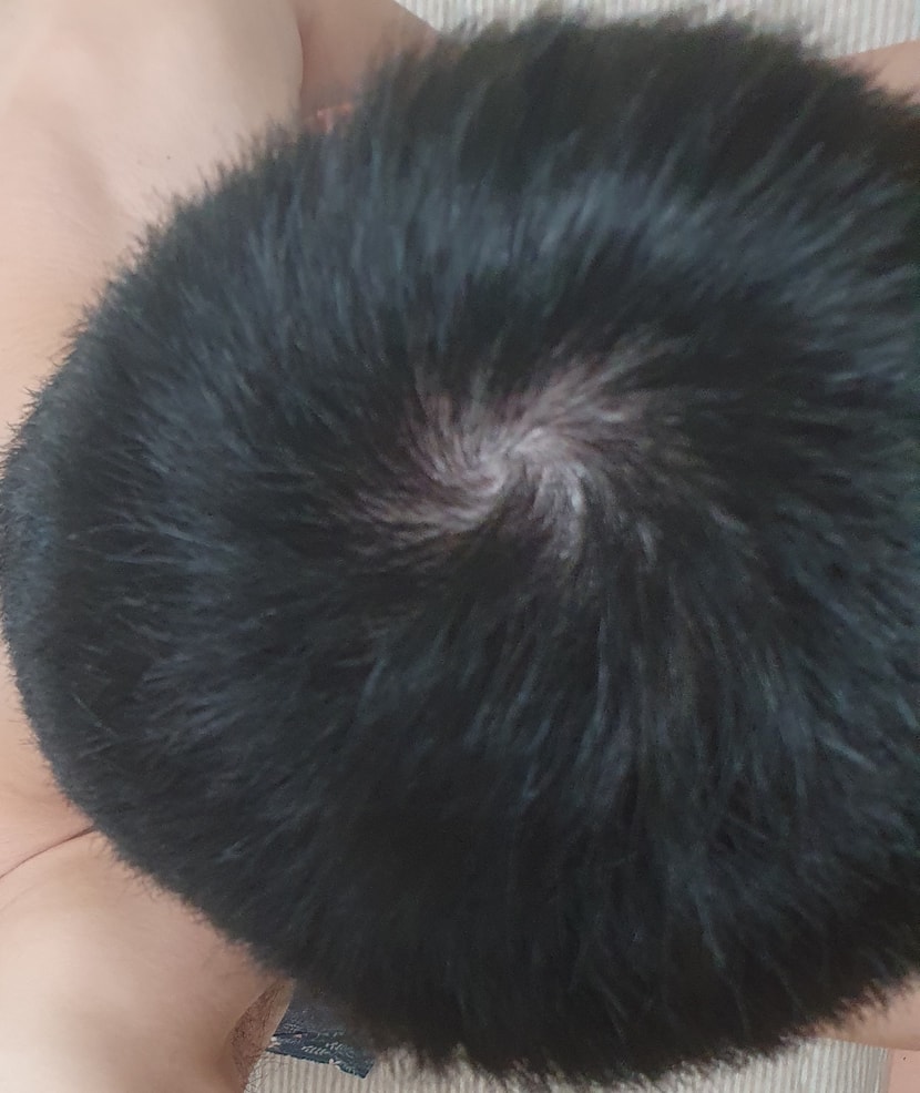 빛 바로 아래서 찍은거
