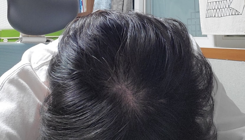 7개월전