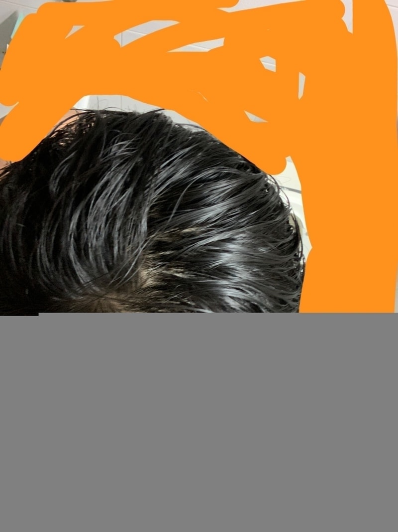 正在考虑变更为avotro...