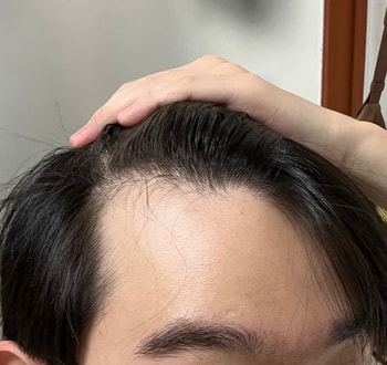 왼쪽 M자