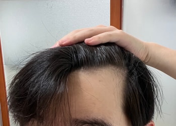 오른쪽 M자