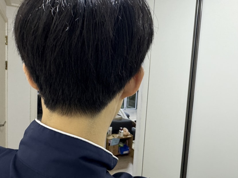 뒷머리