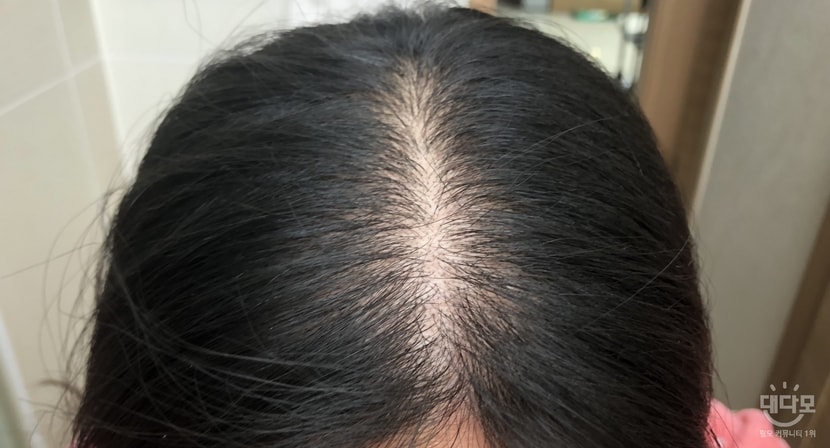 1/16 미녹시작전