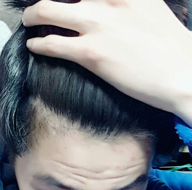 왼쪽