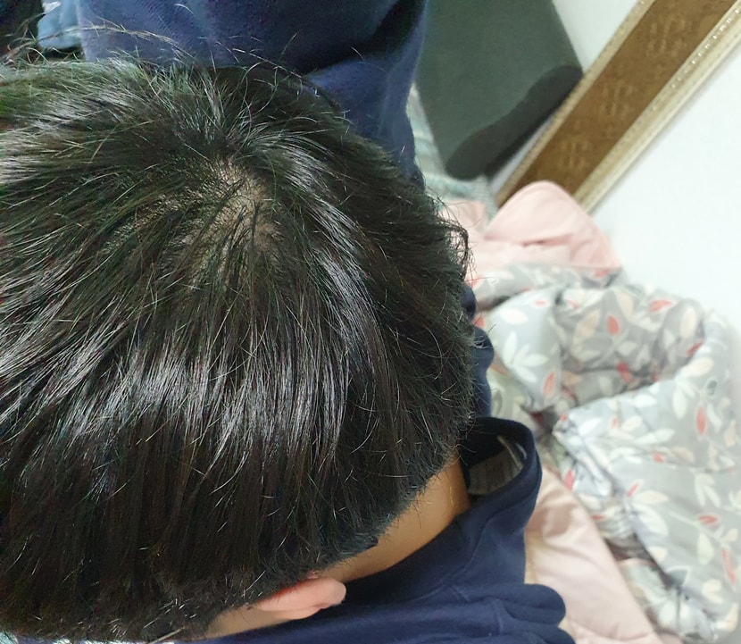 오른쪽 위에서 본 모습