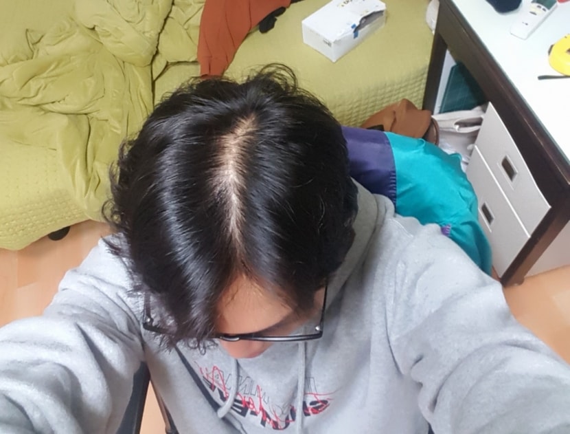 빛 직빵으로 받을때