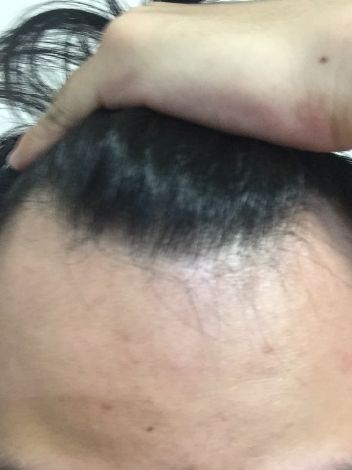 머리