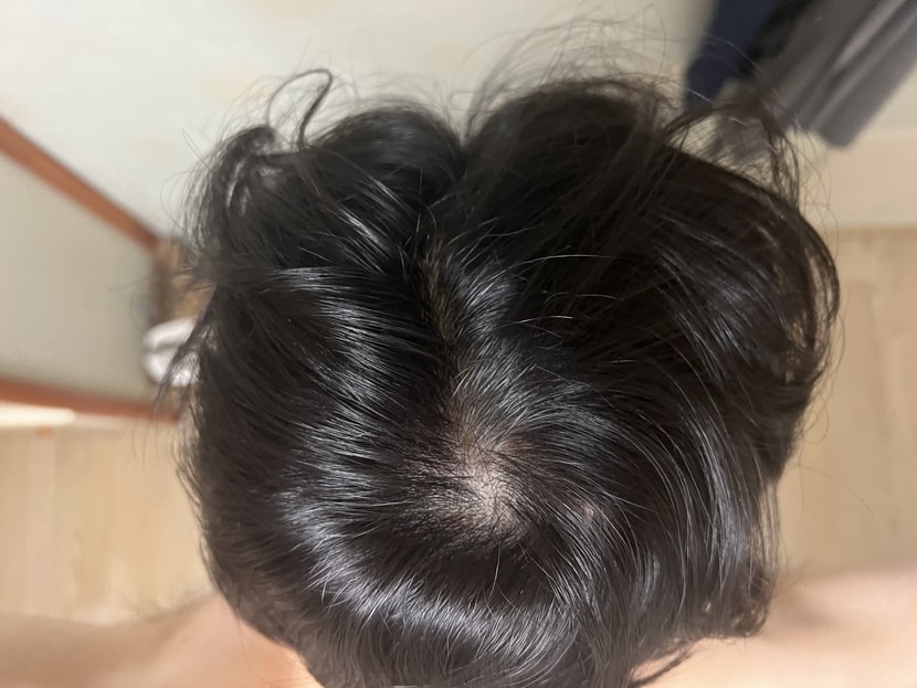 정수리