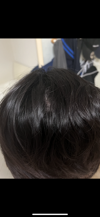 뒷통수