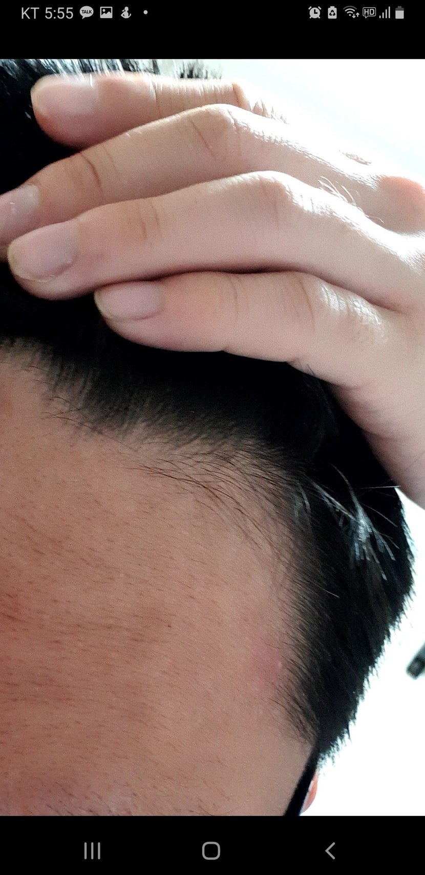 오른쪽 m자