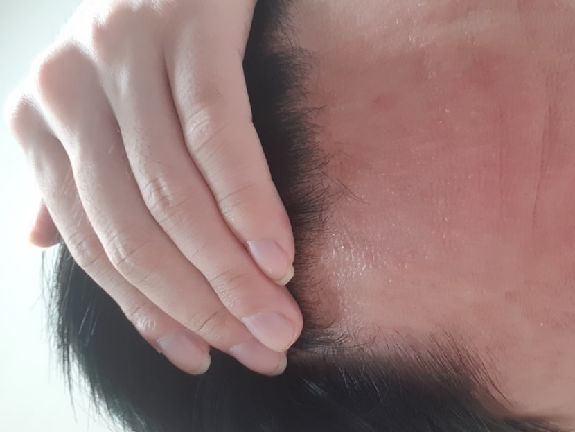 왼쪽