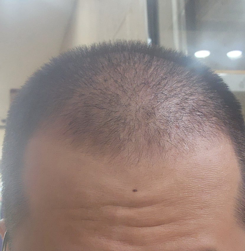 입대 3일 전 단골 미용실에서 머리를 밀어준 뒤, 집에 가는 길