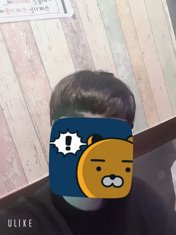 21년 8월입니다.  그나마 살아있는 앞머리. 이때부터 두타놀을 먹었습니다. 