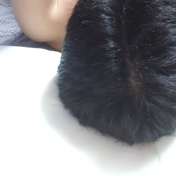 정수리4