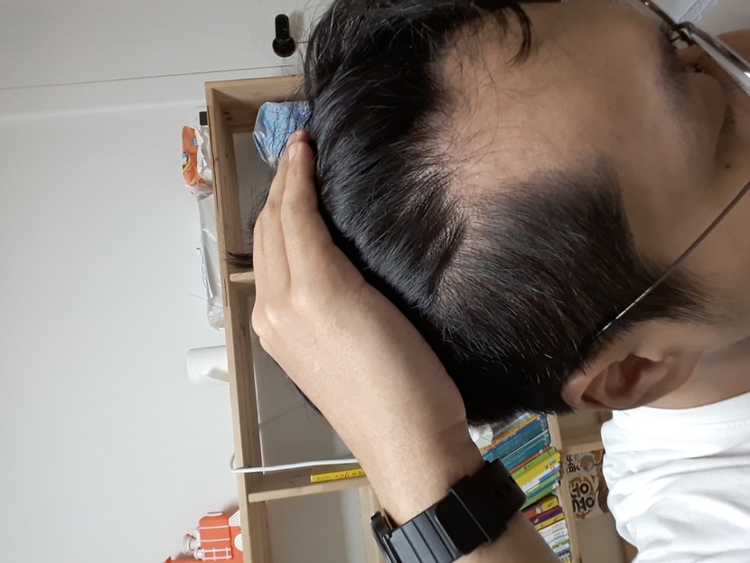 한쪽만 좀 심함
