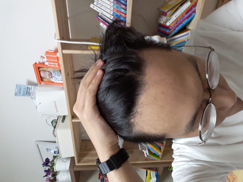 정면샷