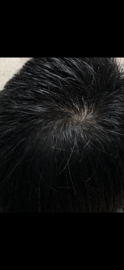 일주일전