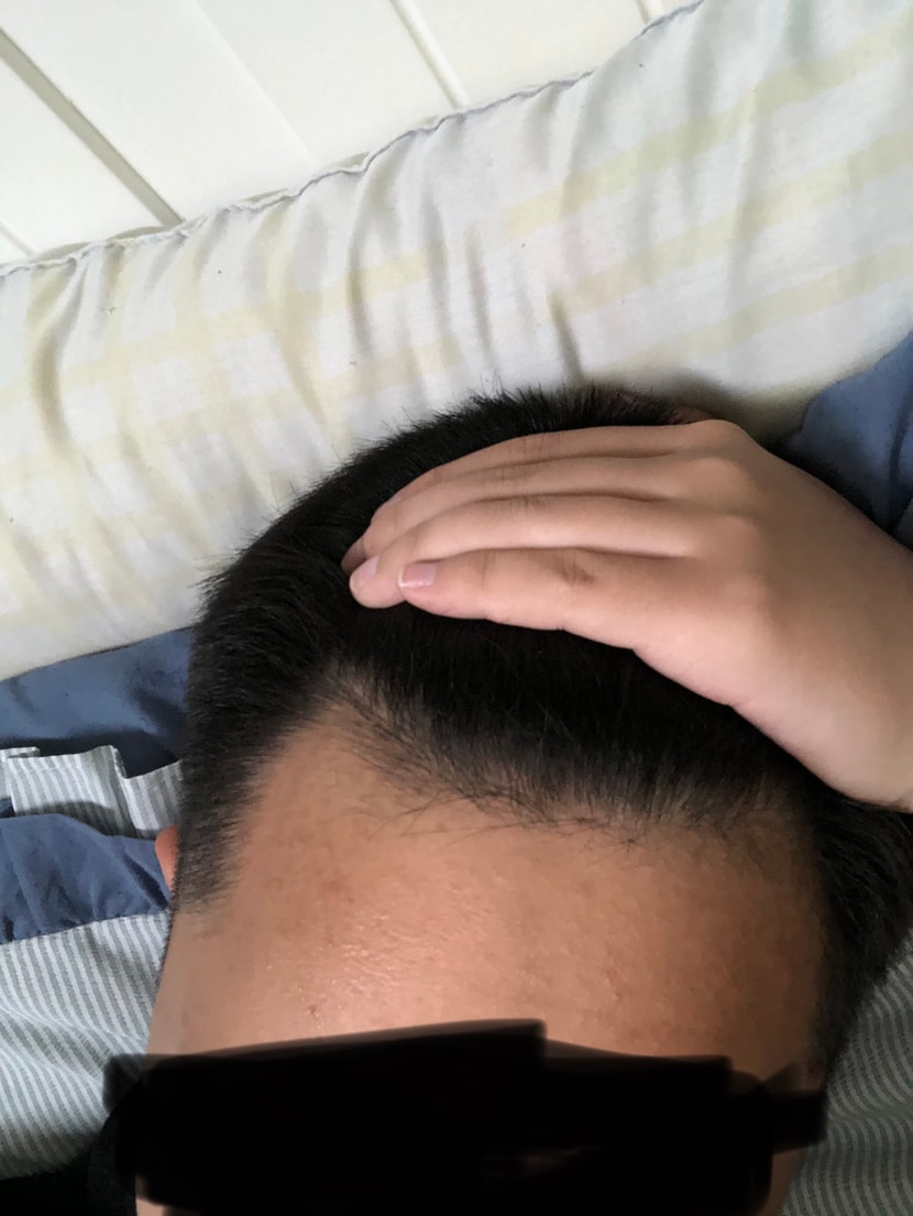 앞