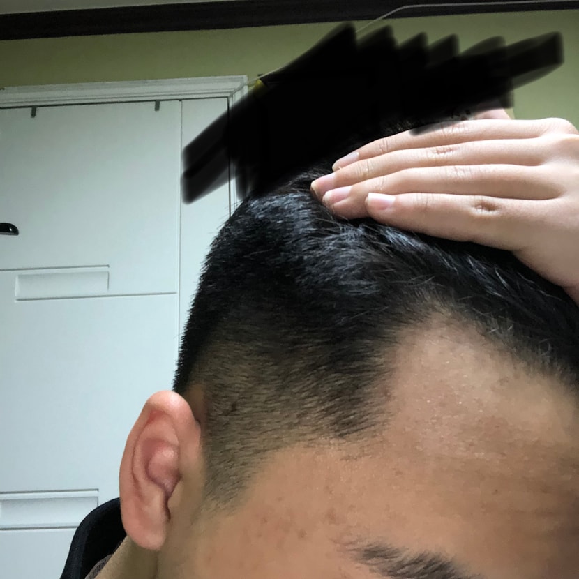옆